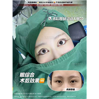 上海眼整形价格
