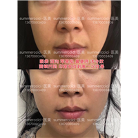 印第安纹2次后效果 