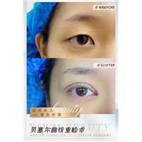 朱正道眼综合整形