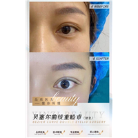 朱正道眼综合整形