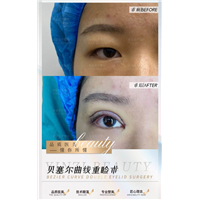 朱正道眼综合整形