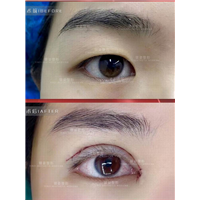 广州眼综合整形专家