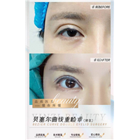 广州眼综合整形专家