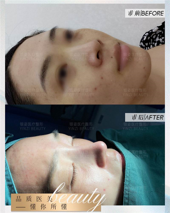 广州鼻整形专家朱正道院长