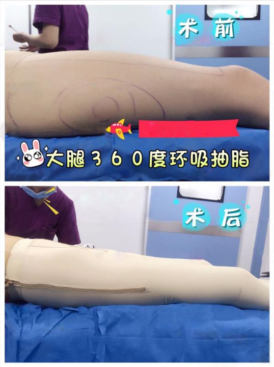 上海微加医美