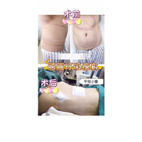 上海微加医美