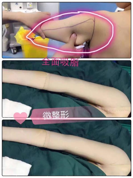 上海微加医美