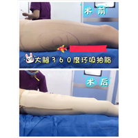 上海微加医美