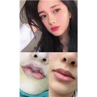 上海微加医疗美容怎么样