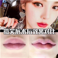 上海微加医疗美容怎么样