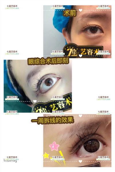 上海专业整形修复|上海哪家医院比较专业