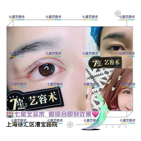 上海做大腿抽脂手术哪家好