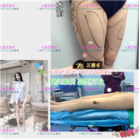 上海哪家医院做鼻综合比较好