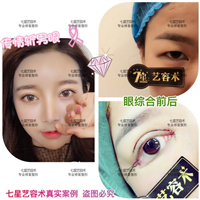 上海专业整形修复|上海哪家医院比较专业