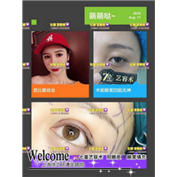 上海全脸脂肪填充多少钱