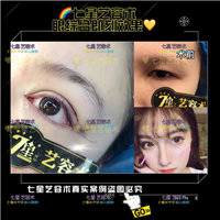 上海**网红整形|上海肋骨隆鼻整形