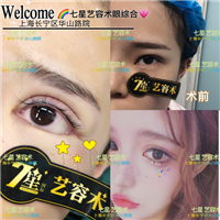 上海**网红整形|上海肋骨隆鼻整形