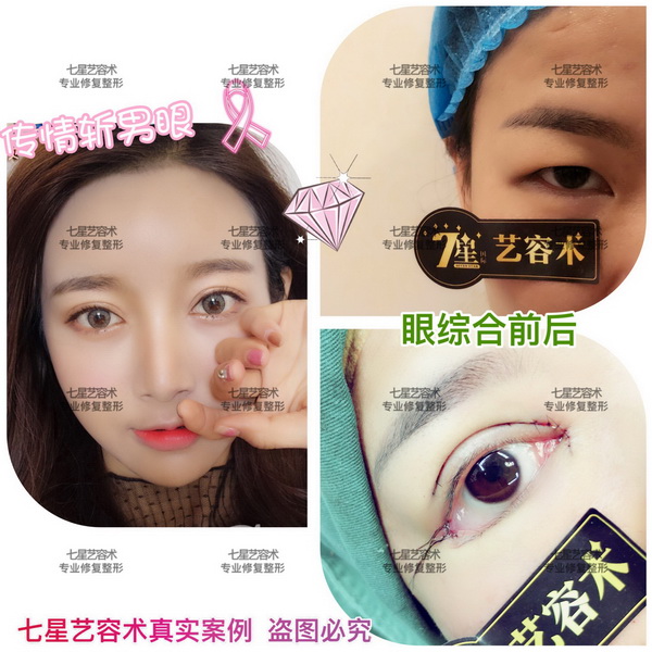 上海专业整形修复|上海哪家医院比较专业
