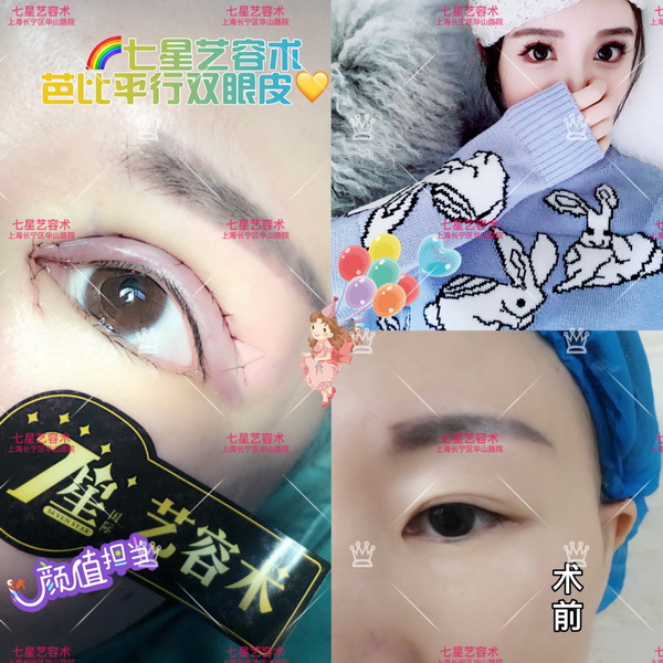 上海专业整形修复|上海哪家医院比较专业