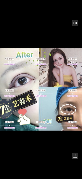 上海专业整形修复|上海哪家医院比较专业