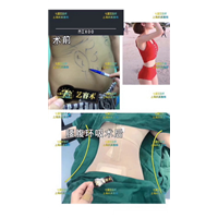 上海哪家医院做鼻综合比较好