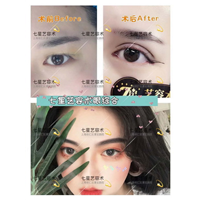 上海肋骨隆鼻整形|上海做眼综合哪家好