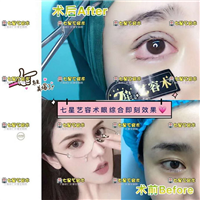 上海做大腿抽脂手术哪家好
