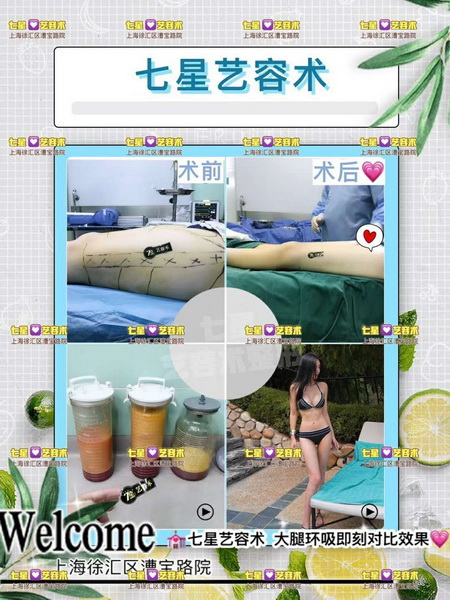上海网红常去的整形医院