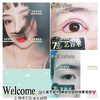 上海做大腿抽脂手术哪家好