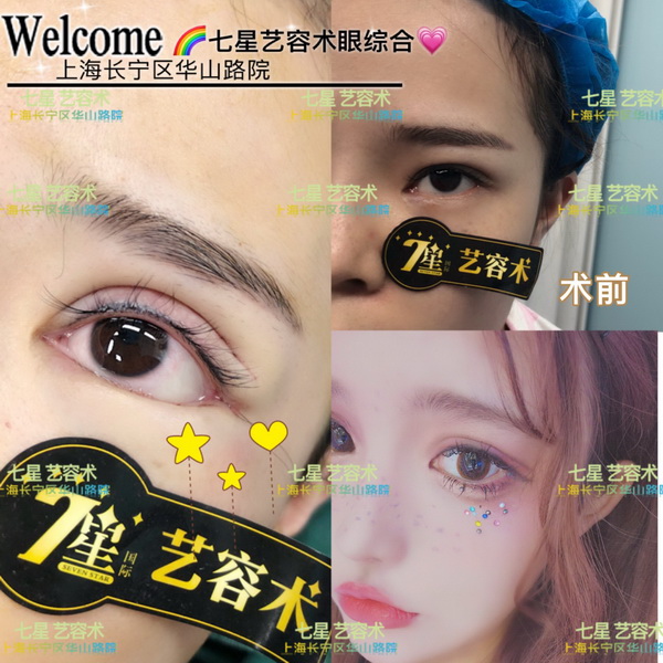 上海**网红整形|上海肋骨隆鼻整形