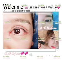 上海网红全脸打造手术