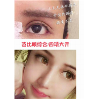 乐山鼻综合整形@乐山自体脂肪整形