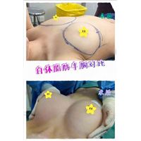 乐山网红整形医院@乐山眼综合整形