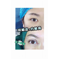 乐山自体脂肪整形、乐山美容整形医院