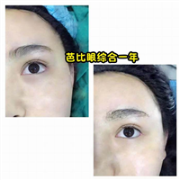乐山眼综合整形@乐山鼻综合整形