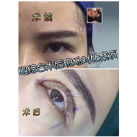 乐山眼综合整形@乐山鼻综合整形