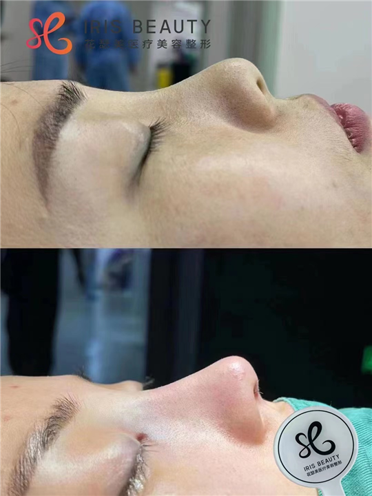 花瑟美鼻综合整形