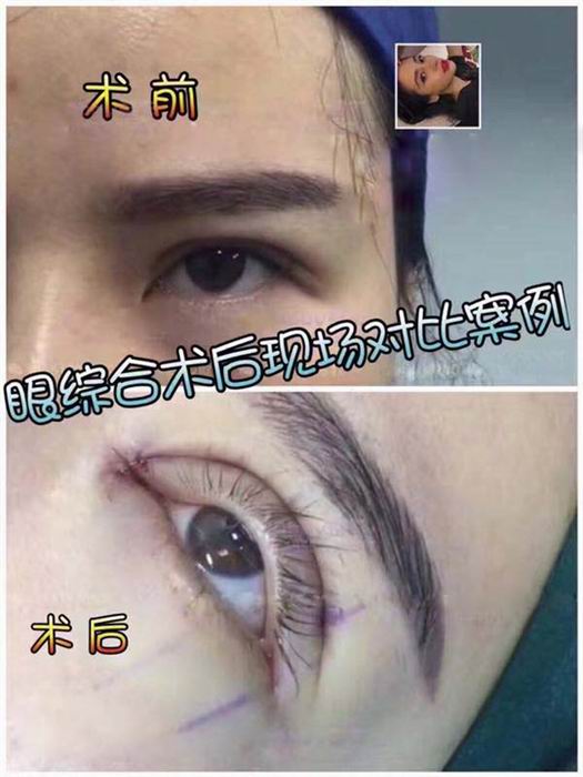 乐山眼综合整形@乐山鼻综合整形