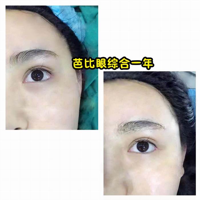 乐山眼综合整形@乐山鼻综合整形