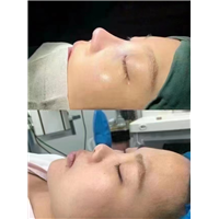 上海微加鼻综合整形
