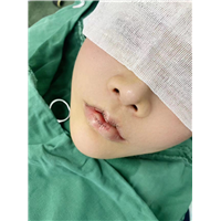 上海微加医疗美容M唇