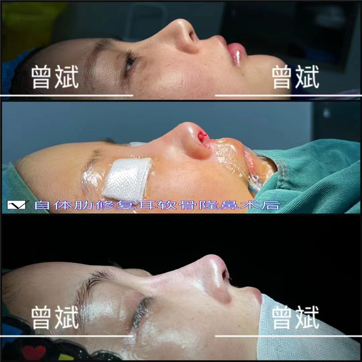 曾斌整形医生