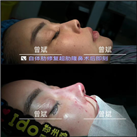 曾斌医生怎么样