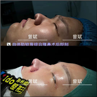 郑州曾斌医生案例