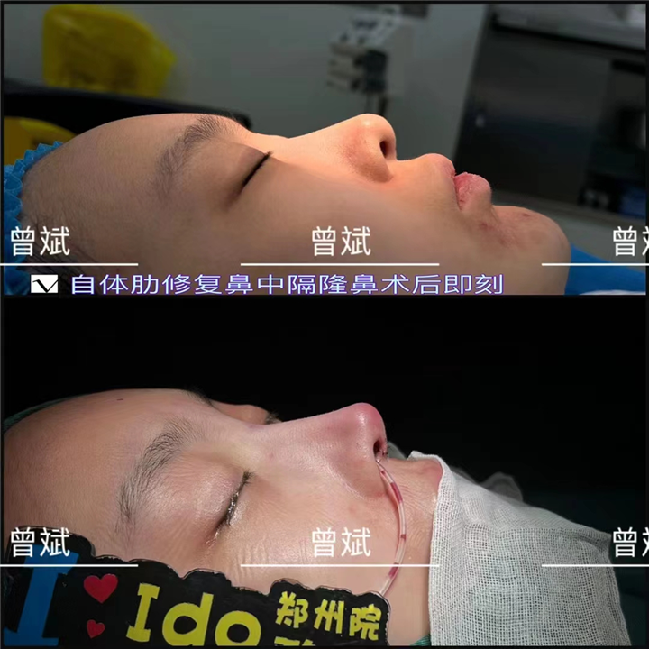 郑州曾斌