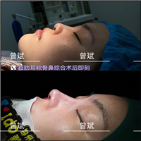 曾斌医生