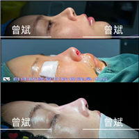 曾斌整形医生