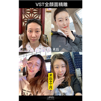 北京做脂肪填充有名的医生 