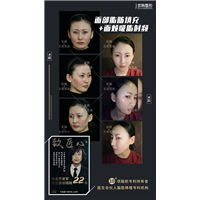 乔爱军脸部脂肪填充案例 