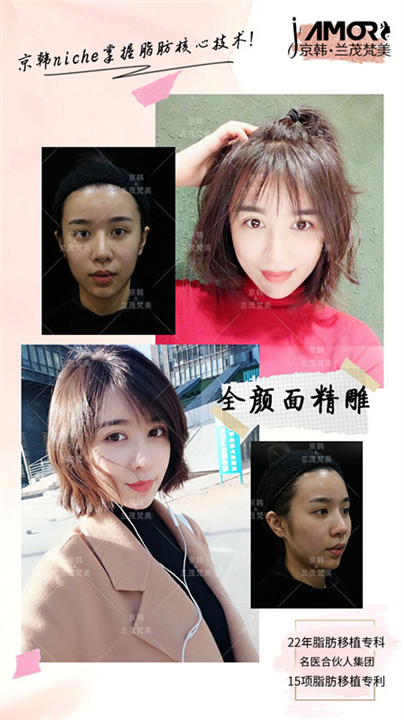 北京自体脂肪填充哪家好 
